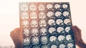 Beyin ve Sinir Cerrahisi (Nöroşirürji)