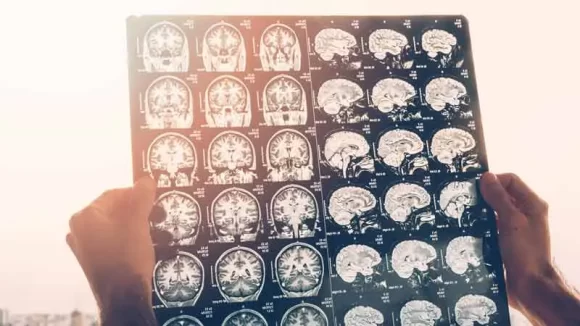 Beyin ve Sinir Cerrahisi (Nöroşirürji)