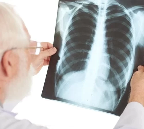 göğüs hastalıkları