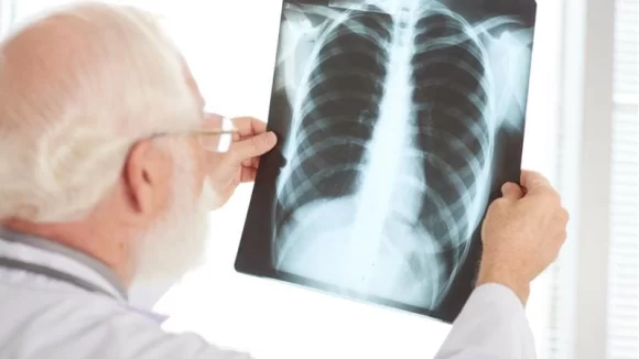 göğüs hastalıkları