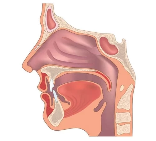 Kulak Burun Boğaz | KBB