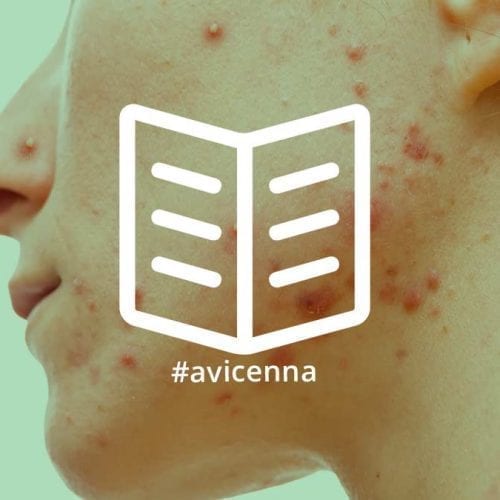 Sivilce: Akne Vulgaris