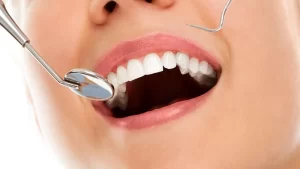 Diş eti çekilmesi işlemi