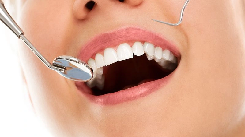 Diş eti çekilmesi işlemi