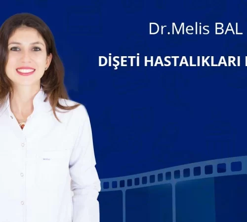 Dişeti hastalıkları nedir