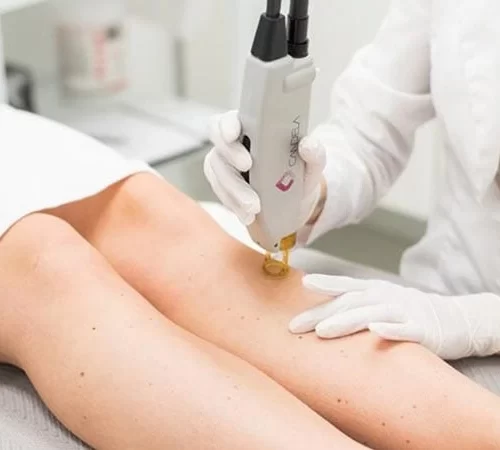 Lazer Epilasyon ve Medikal Estetik