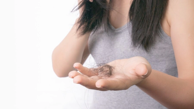 Saç dökülmesi yaşayan kadın
