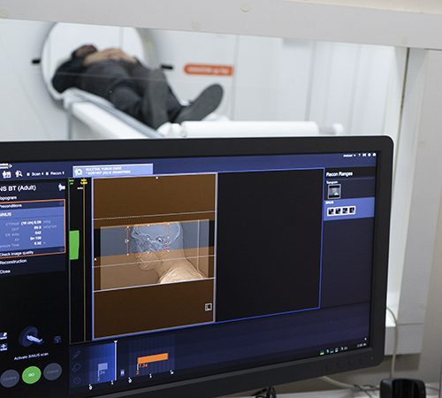 Bilgisayarlı Tomografi (BT)