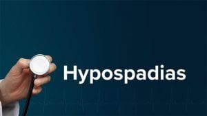 جراحة المبال التحتاني (Hypospadias)