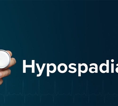 جراحة المبال التحتاني (Hypospadias)