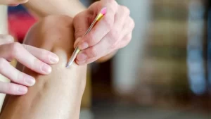 Kıl dönmesi sorunu yaşayan kişi