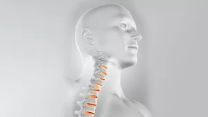 boyun düzleşmesi görüntüsü