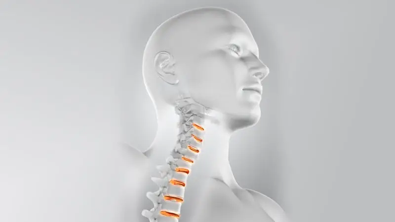 boyun düzleşmesi görüntüsü