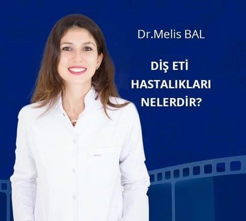 Diş eti hastalıkları nelerdir