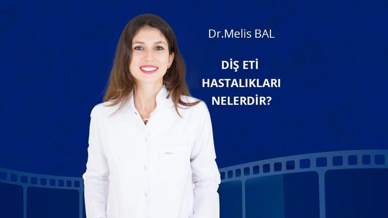 Diş eti hastalıkları nelerdir