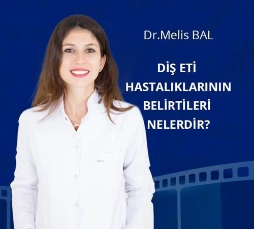 diş eti hastalıklarının belirtileri nelerdir