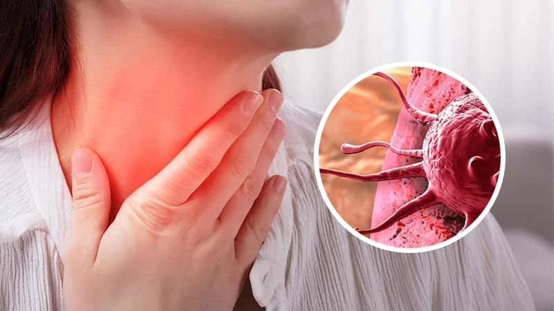 Lenf kanseri olan kadın