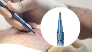 Safir FUE Saç Ekimi