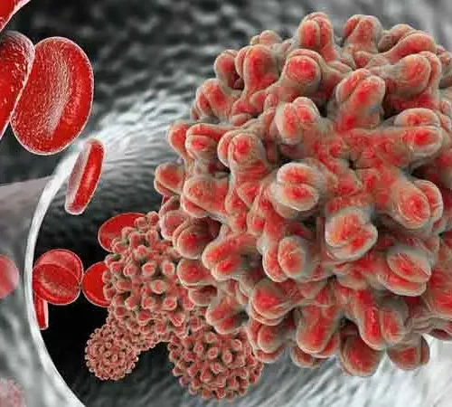 hepatit c virüsü