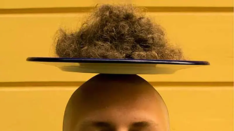 kıvırcık saça saç ekimi