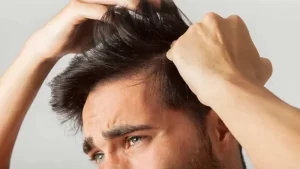 organik saç ekimi yapılan erkek