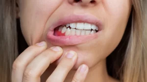 Uyurken Ağızdan Kan Gelmesi Nedenleri