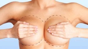 Breast Aesthetics