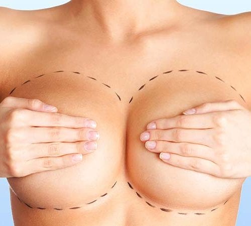 Breast Aesthetics