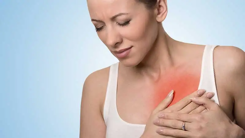 mastrit yaşayan kadın