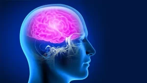 beyin anevrizması görüntüsü