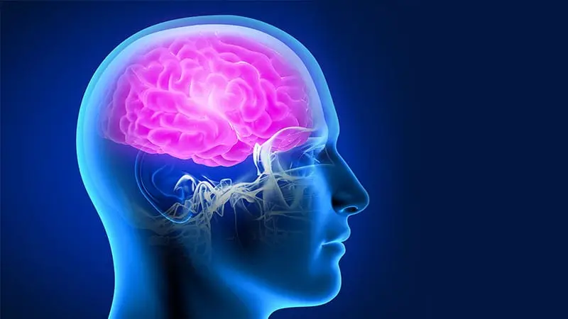 beyin anevrizması görüntüsü