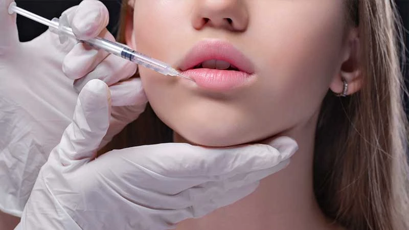 Dudak Estetiği Uygulaması