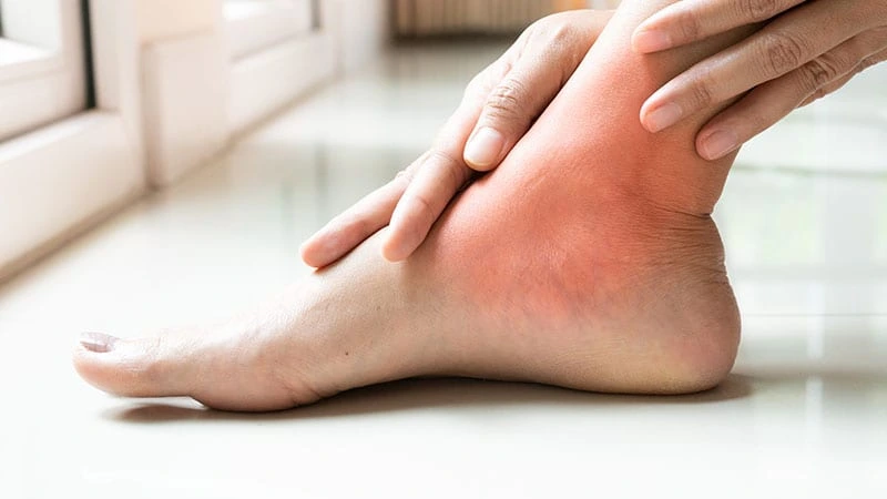 Ayak bileği yaralanmaları