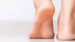 Nasır sorunu olan kişi