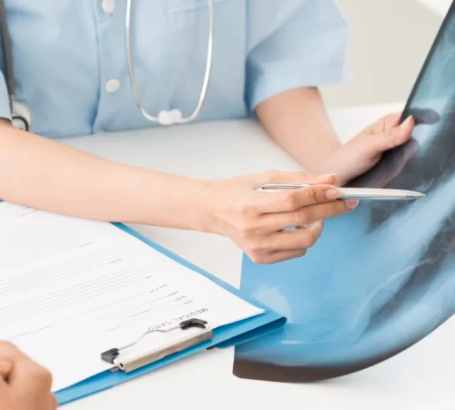 Pulmoner Fibrozis (Akciğer Sertleşmesi) Muayenesi