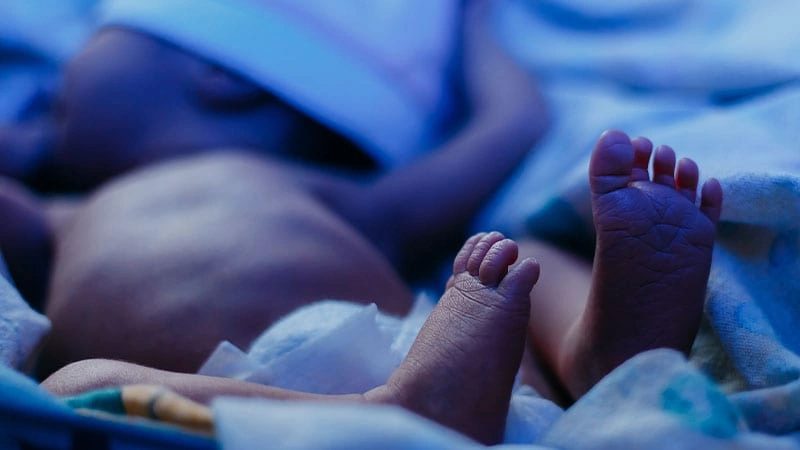 Bebeklerde sarılık problemi