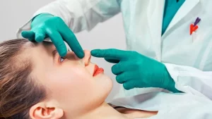 Revizyon burun estetiği yaptıran kadın