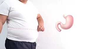 Revizyon mide ameliyatları için ölçüm