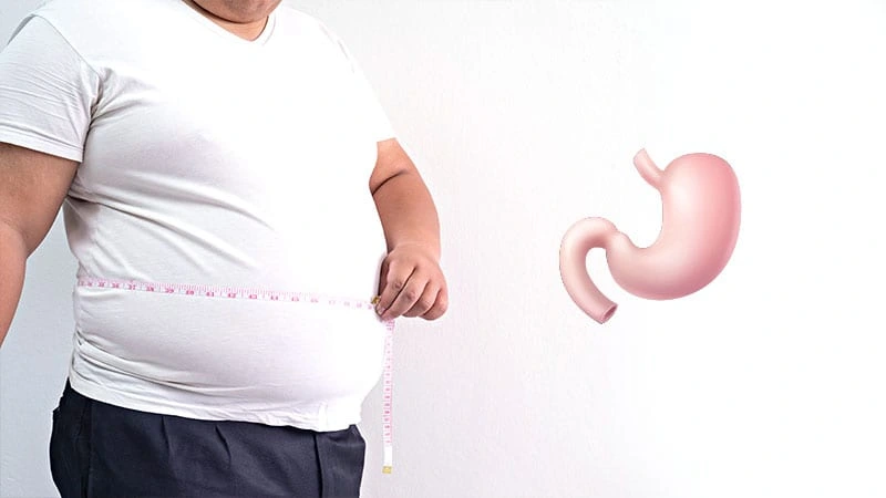 Revizyon mide ameliyatları için ölçüm