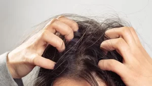 Saç Derisi Kaşıntısı