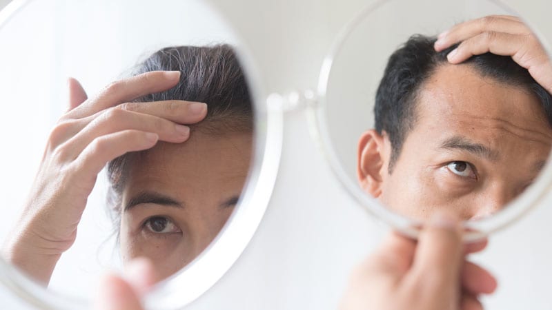 من يمكنه إجراء زراعة الشعر