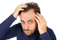 Saç Çizgisinin Gerilemesi