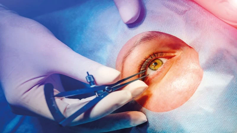 Şaşılık ameliyatı tedavisi