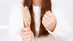 Traksiyonel Alopesi Hastası Kadın