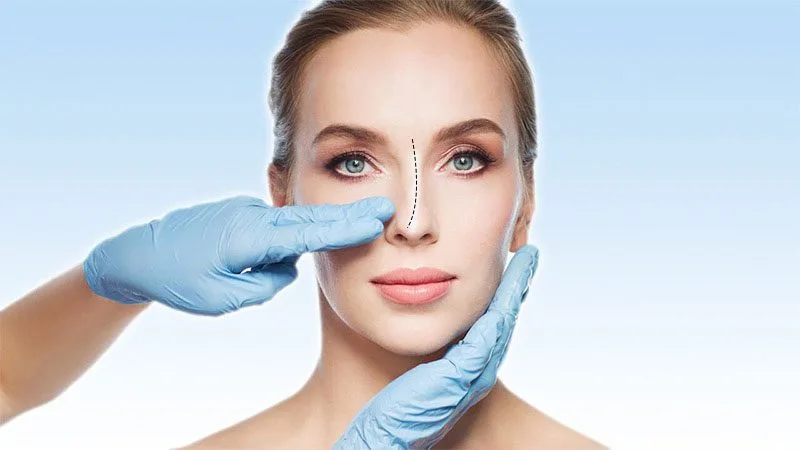 burun eğriliği olan kadın