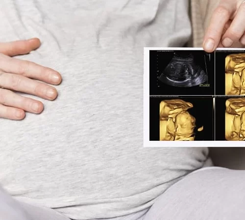 4 boyutlu ultrason görüntülemesi yapılan kadın