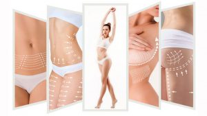 Plastic and Reconstructive surgery