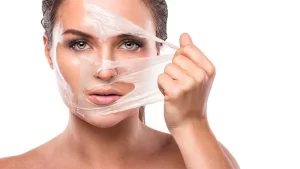 Kimyasal Peeling Sonrası