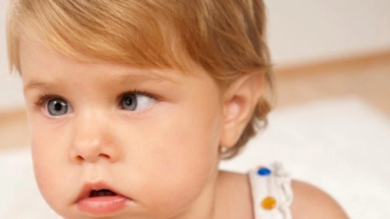 Şaşılık (Gözlerde Kayma) hastası çocuk