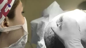 soft fue saç ekimi yapan uzman